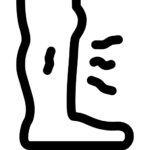 ligament